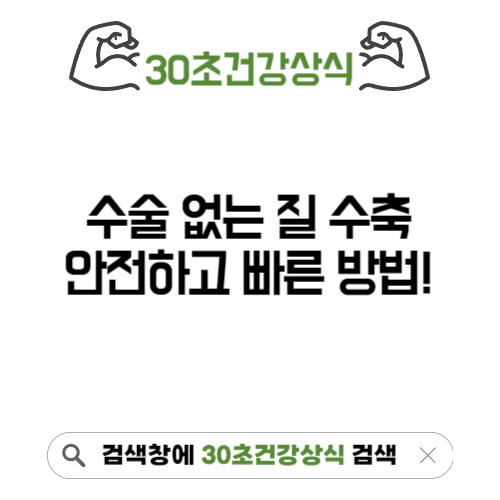 수술없는질수축 방법